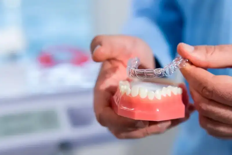 Ile kosztuje Invisalign w Polsce?