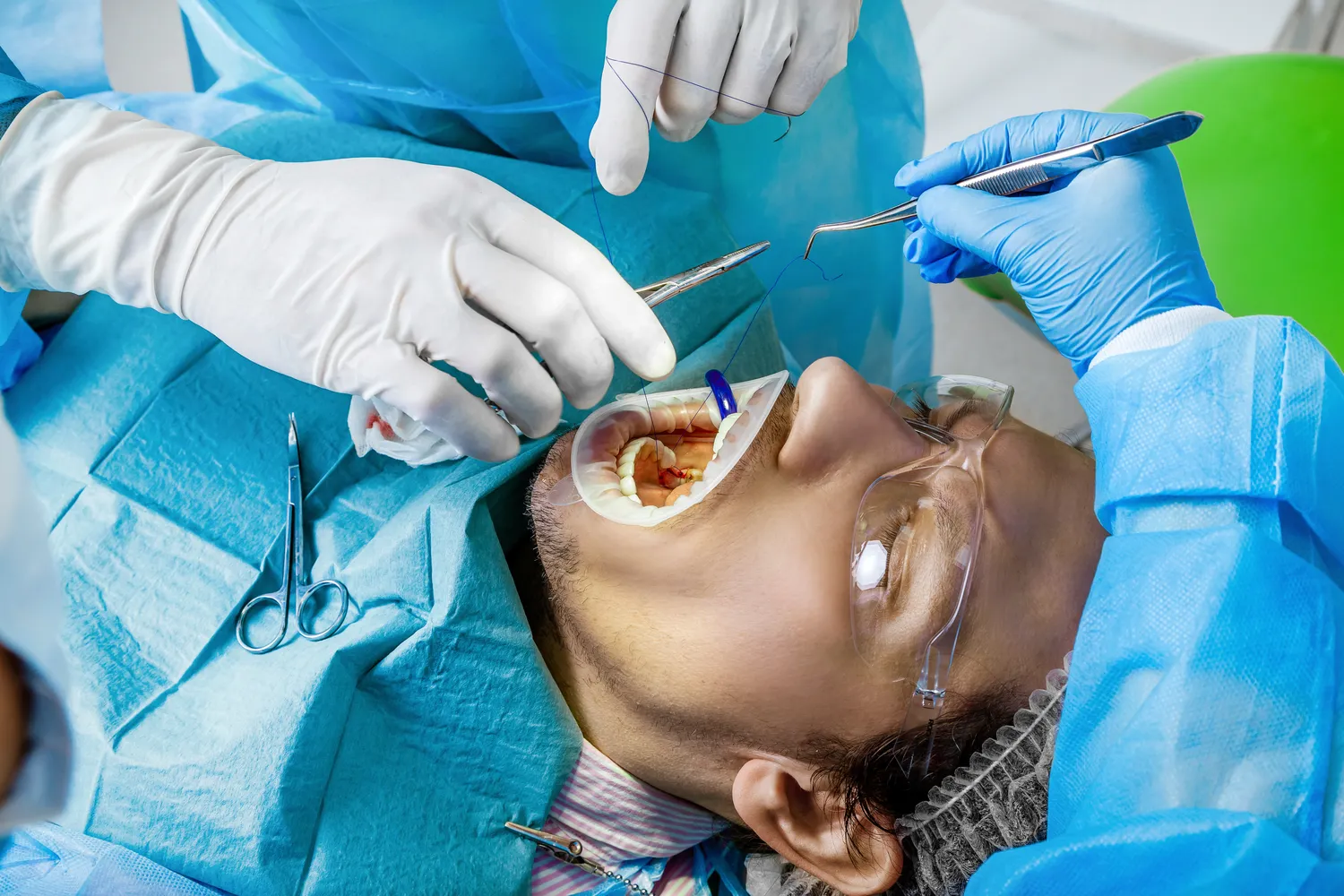 Ile kosztuje jeden implant?