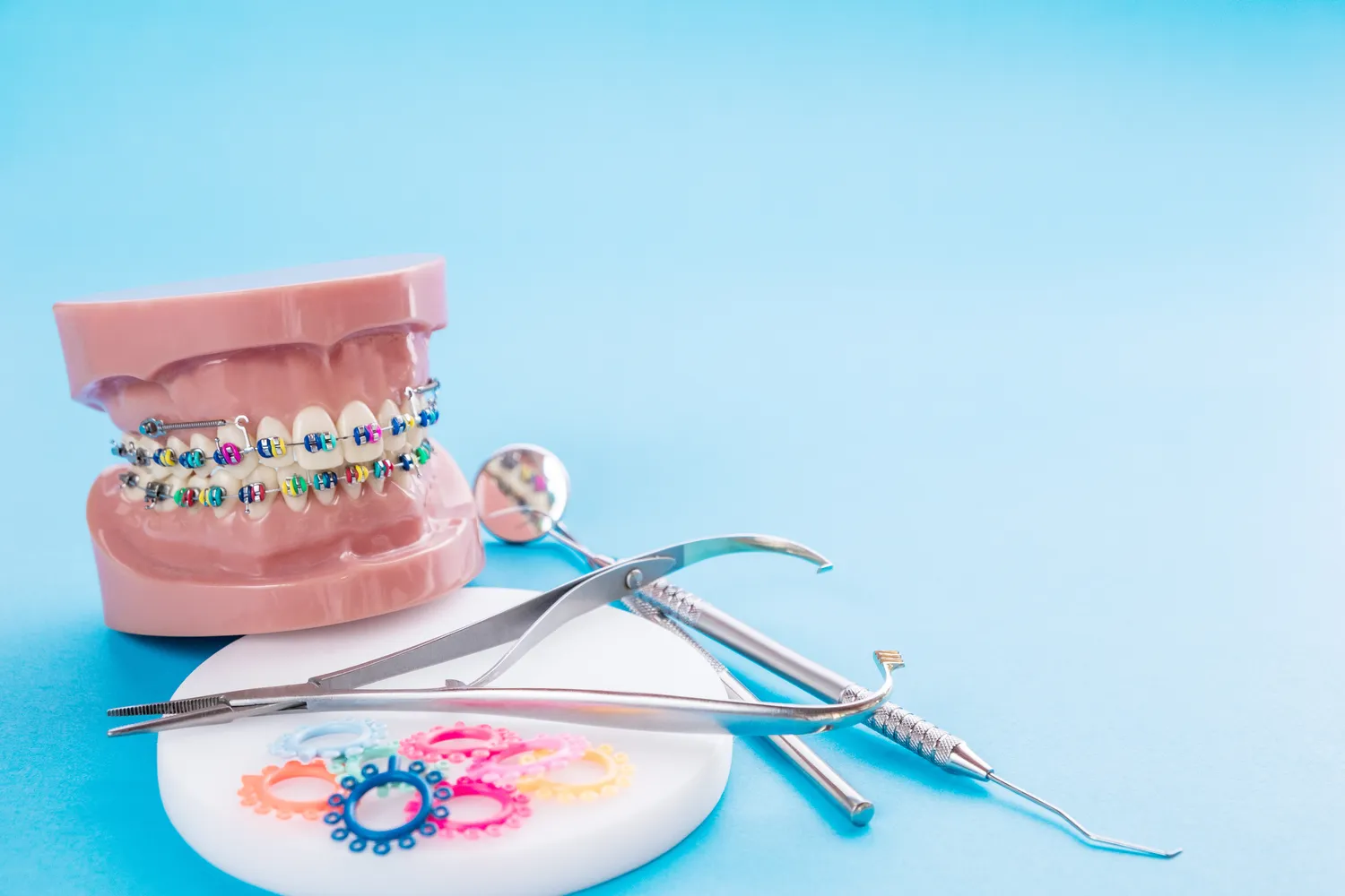 Implanty zębowe – najczęściej zadawane pytania