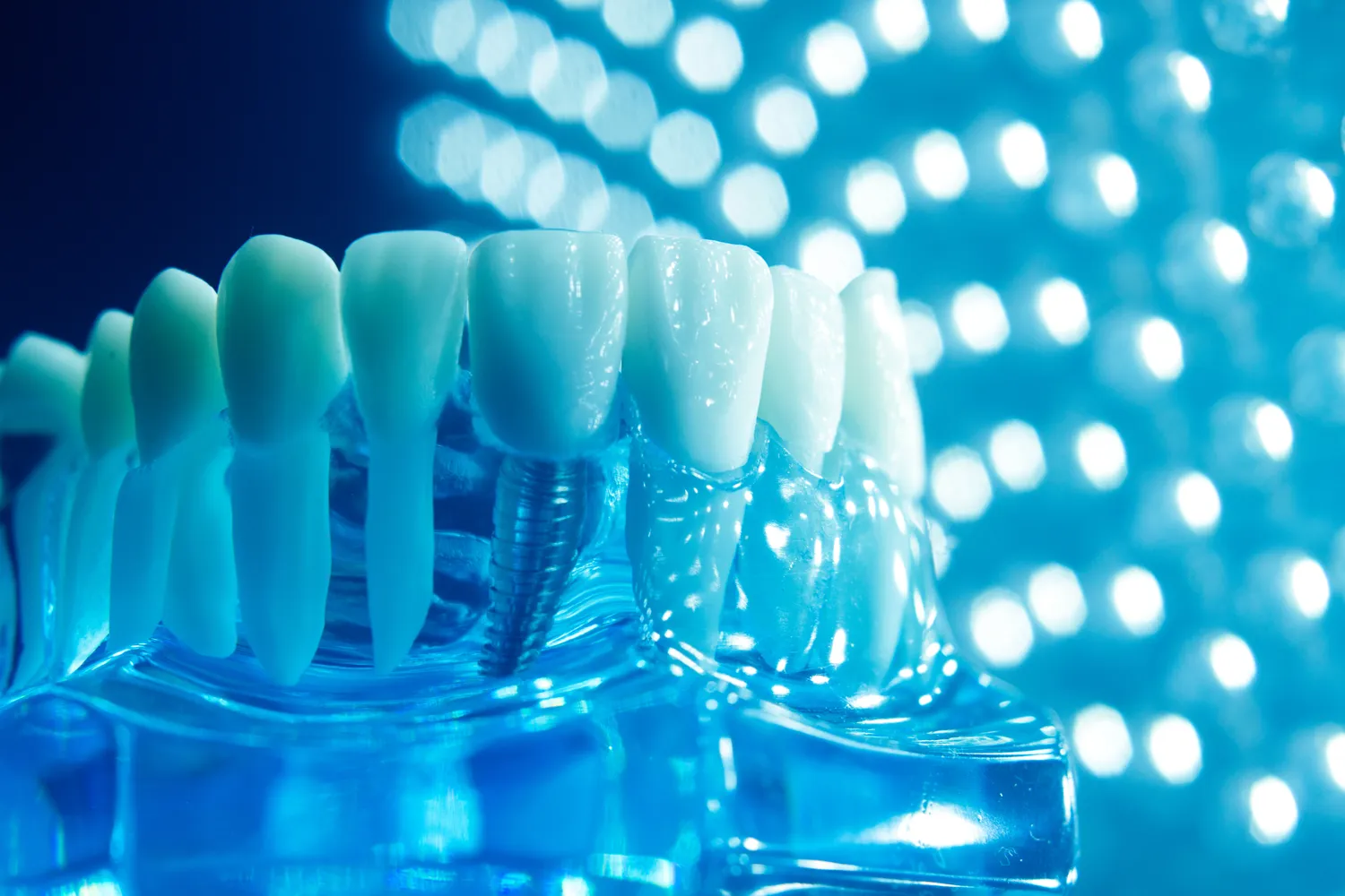 Endodoncja ranking Szczecin