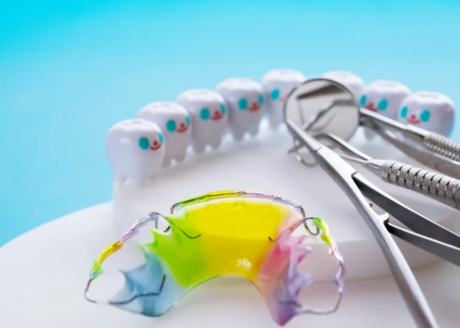 Najlepsze nakładki ortodontyczne Szczecin