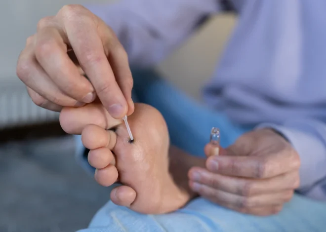 Czy kurzajką można się zarazić?