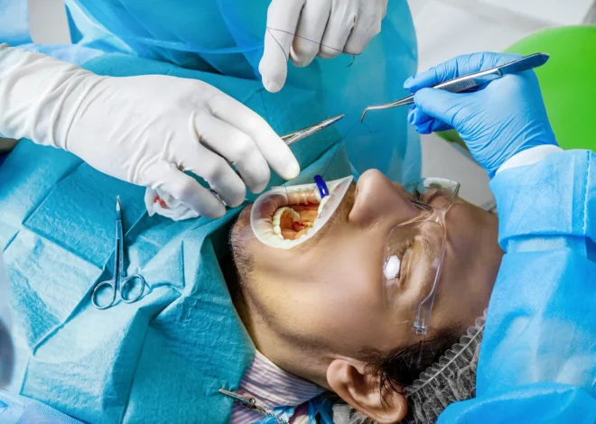 E recepta jak zdobyć?