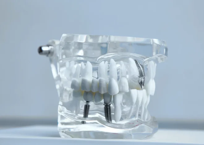 Implanty w jeden dzień Koszalin