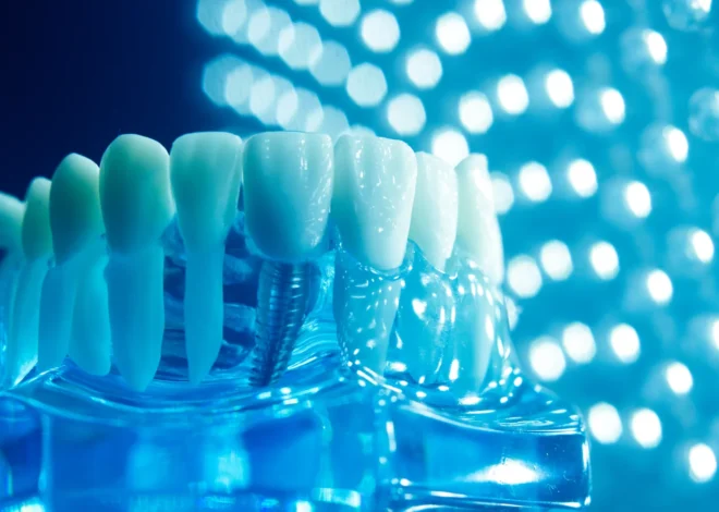 Implanty zębów cała szczęka cena Szczecin