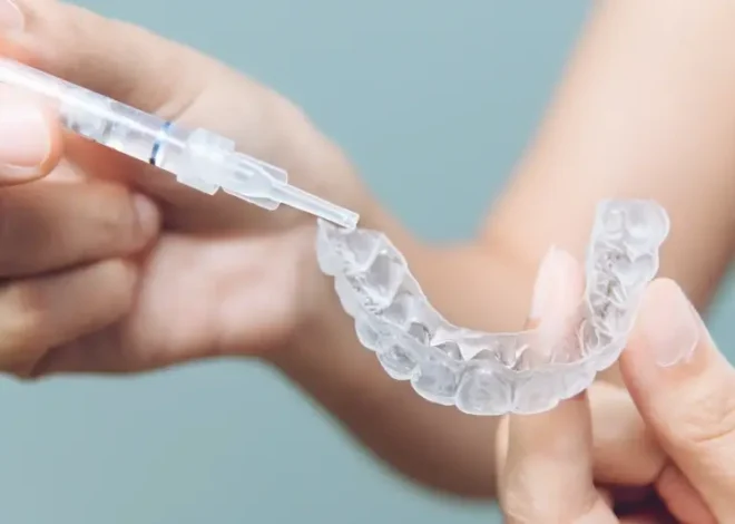 Invisalign dla dzieci