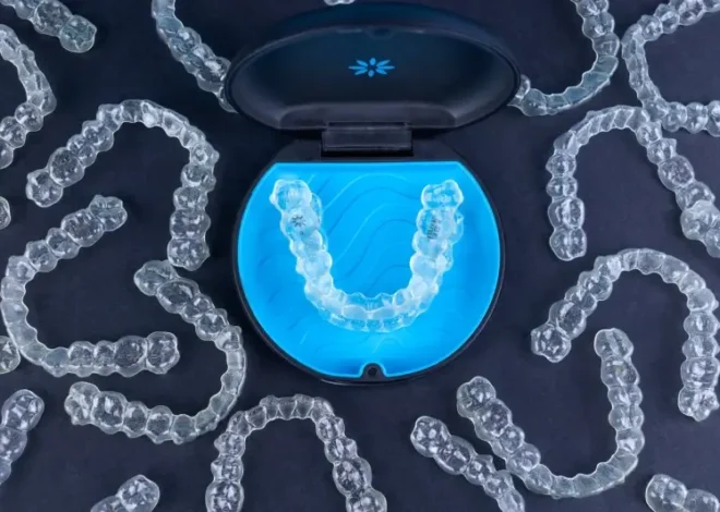Invisalign kiedy efekty?