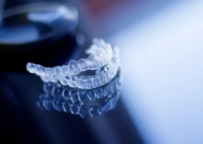 Nakładki Invisalign czy warto?