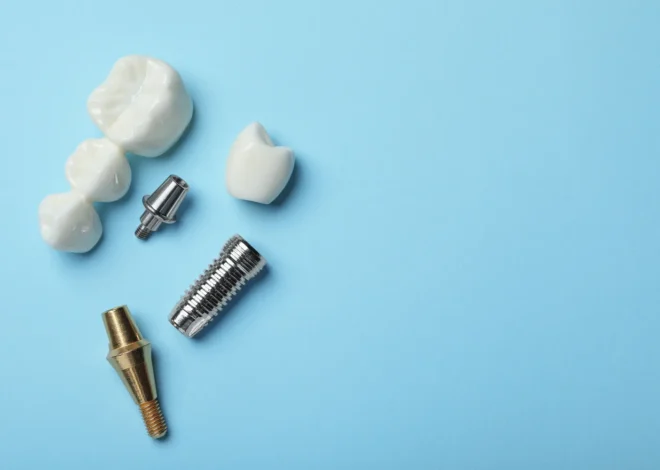 Zęby w jeden dzień Kołobrzeg