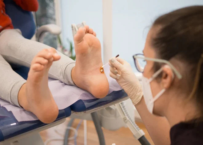 Jaskółcze ziele na kurzajki jak zrobić?