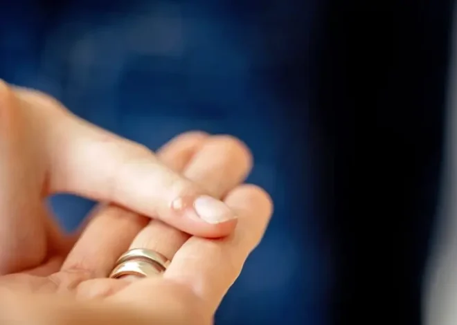 Kurzajki podolog czy dermatolog?