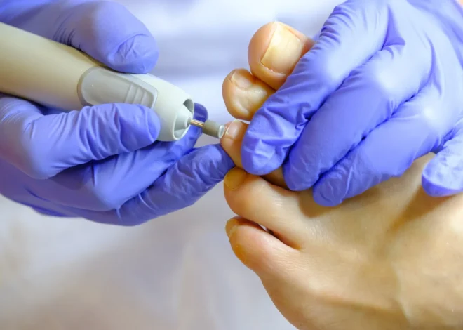 Podologia – co to takiego?