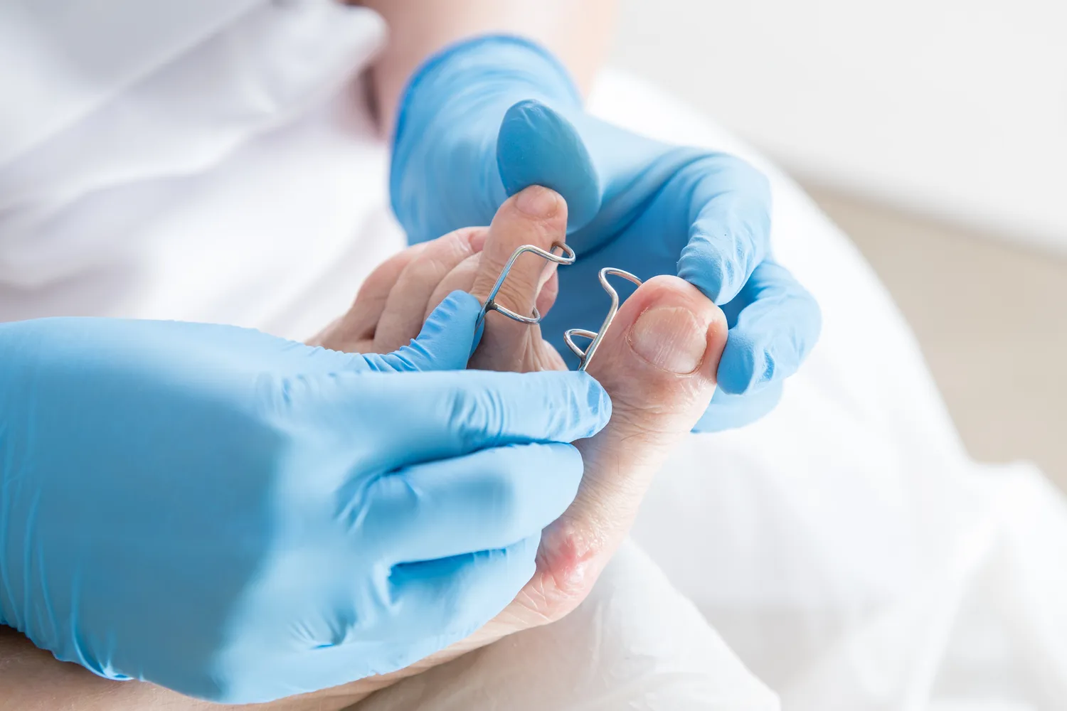 Przygotuj swoje stopy na lato – podologiczne ABC